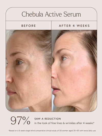 A True Transformation