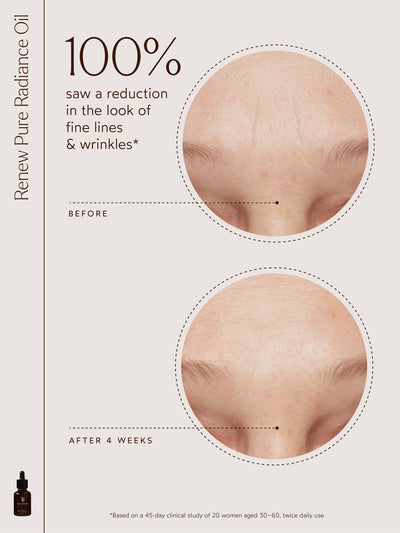 A True Transformation