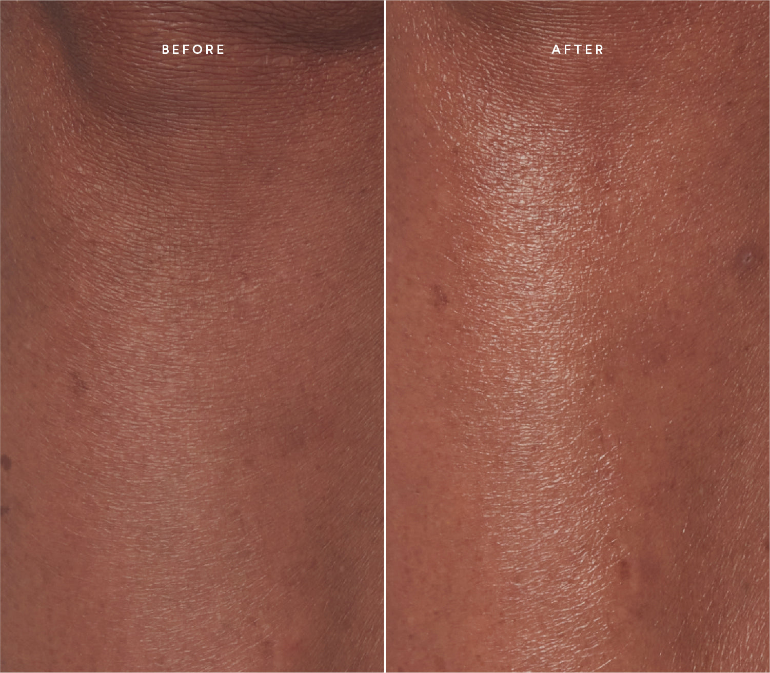 Before and after comparison showing improved skin texture.