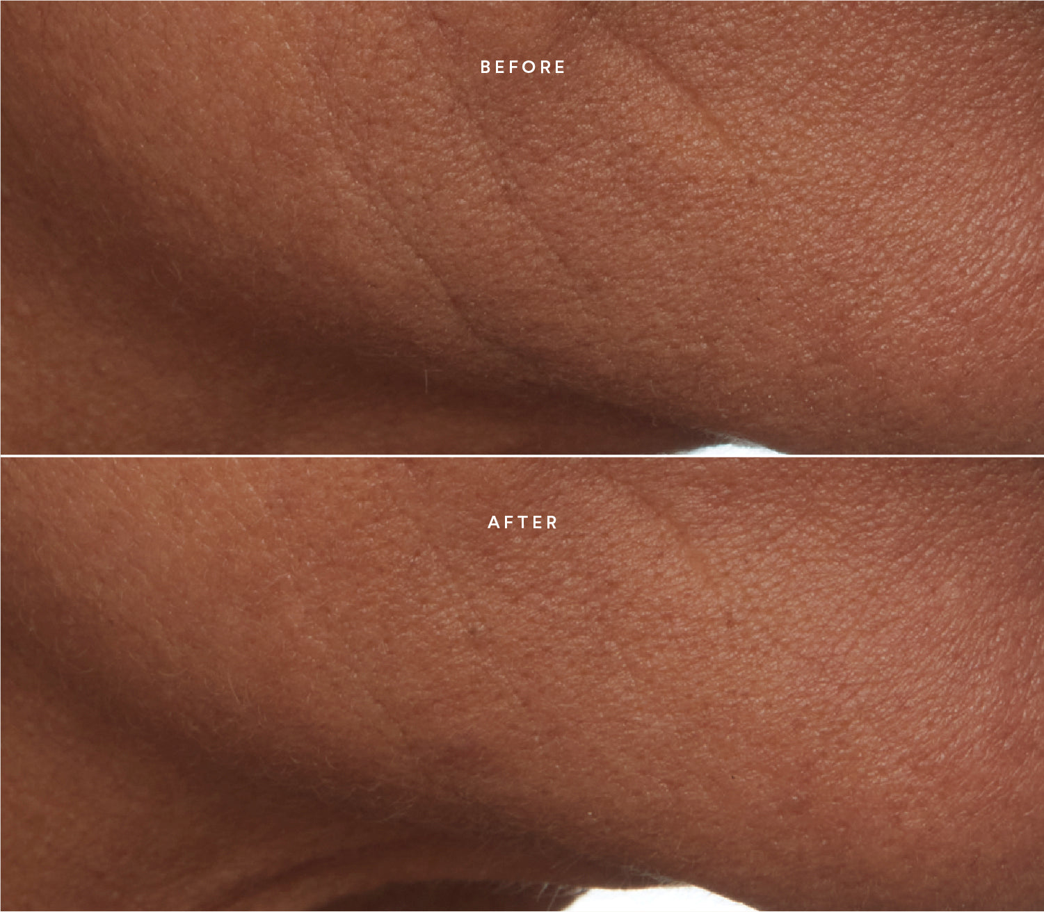 Before and after comparison showing improved skin texture.