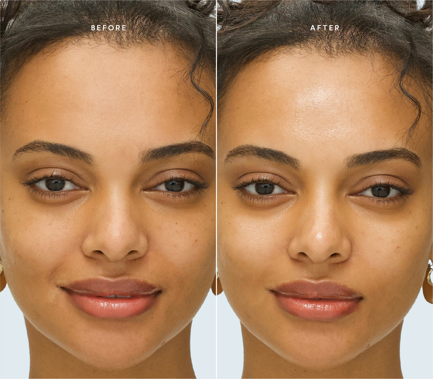 Before and after comparison showing a more even, radiant complexion.