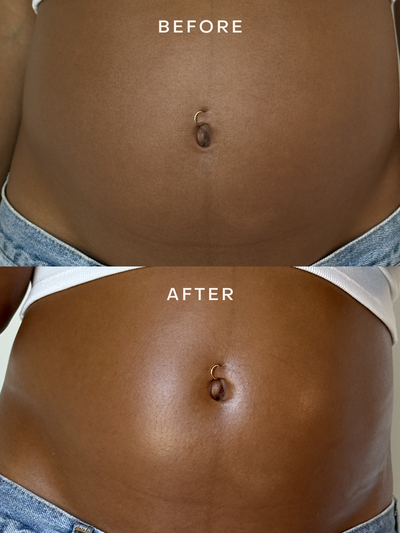 Mindful Mama Belly & Body Oil