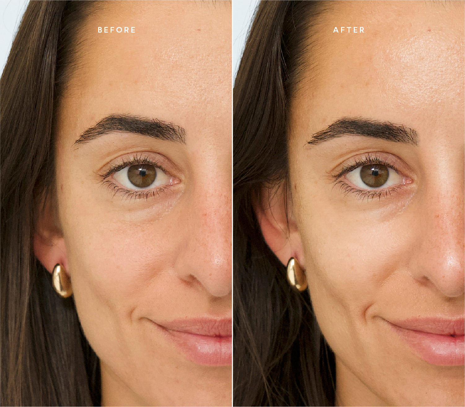 Before and after comparison showing reduced redness and a more even, radiant complexion.