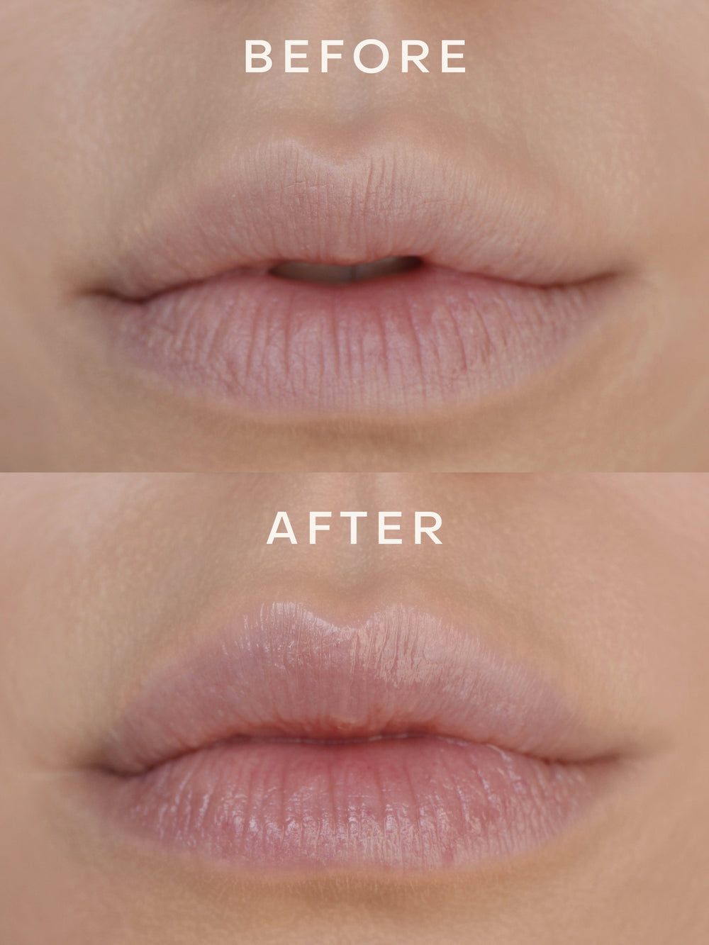 Before and after close-up showing lips before and after applying True Botanicals Lipid Lip Hydrating Lip Oil — the after image shows visibly fuller, smoother, and more hydrated lips.