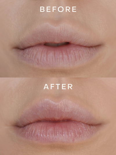 Before and after close-up showing lips before and after applying True Botanicals Lipid Lip Hydrating Lip Oil — the after image shows visibly fuller, smoother, and more hydrated lips.