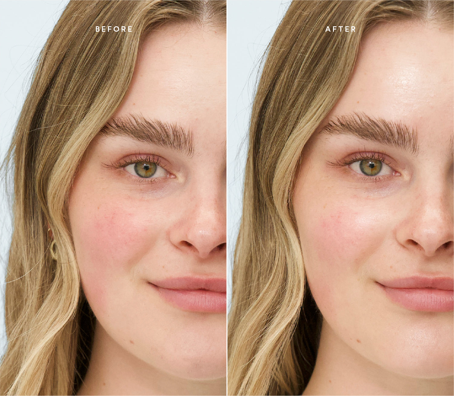 Before and after comparison showing reduced redness and a more even, radiant complexion.