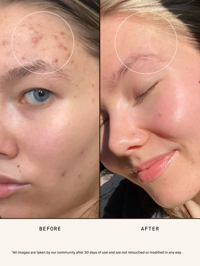 Clear Pure Radiance Oil