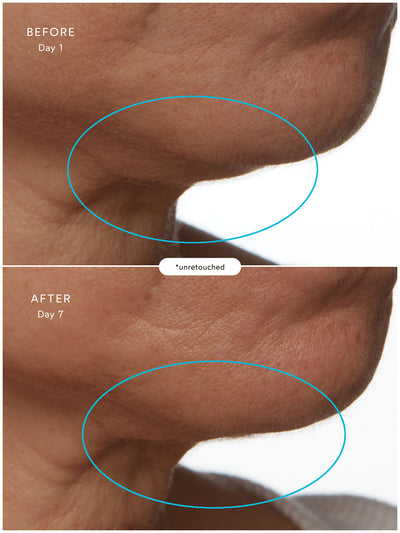 SuperSEA Firming & Lifting Treatment - Thumbnail Image