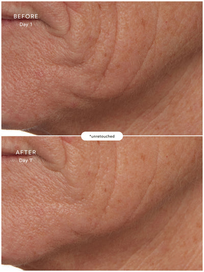 SuperSEA Firming & Lifting Treatment - Thumbnail Image