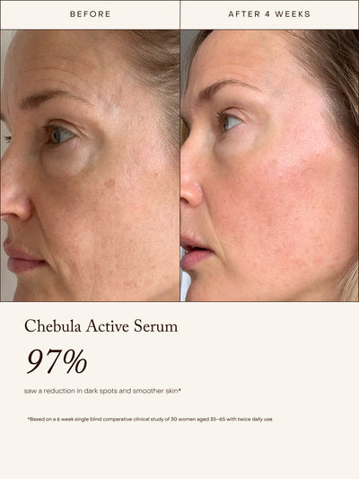 Before-and-after skincare comparison showing a woman's cheek and forehead in two side-by-side panels, with text below reading 'Chebula Active Serum' and '97%'.