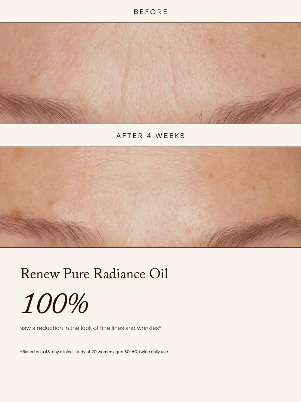Before-and-after skincare comparison showing the forehead and eyebrow area with fine lines and wrinkles reduced over 4 weeks, above text reading 'Renew Pure Radiance Oil 100%'.