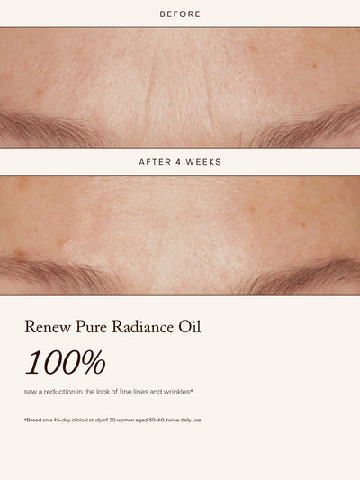 Before-and-after skincare comparison showing the forehead and eyebrow area with fine lines and wrinkles reduced over 4 weeks, above text reading 'Renew Pure Radiance Oil 100%'.