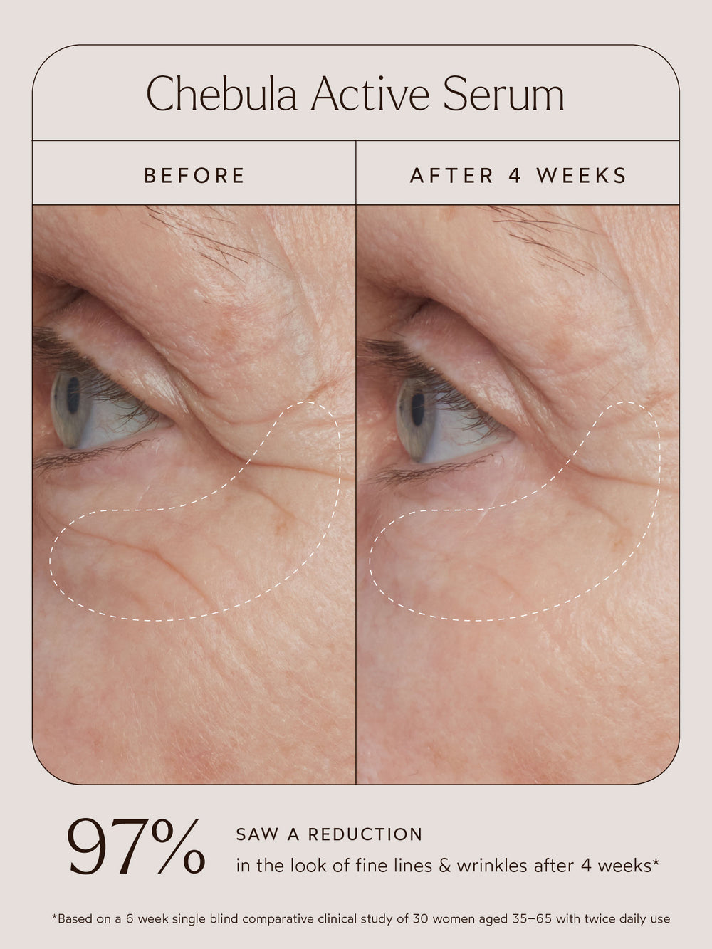 Before and after comparison of the eye area using Chebula Active Serum. The "Before" image shows visible fine lines and wrinkles, while the "After 4 Weeks" image reveals a noticeable reduction in the appearance of fine lines and smoother skin. Below the images, text highlights that 97% of participants saw a reduction in the look of fine lines and wrinkles after 4 weeks, based on a 6-week single-blind comparative clinical study of 30 women aged 35–65, with twice-daily use.