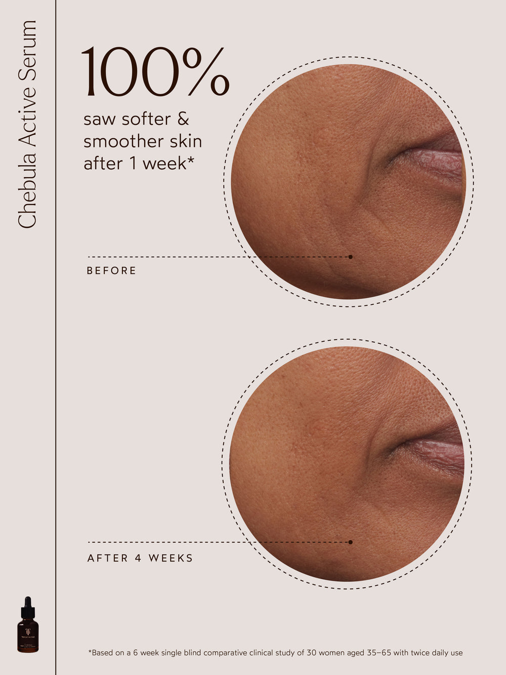 The image highlights that "100% saw softer & smoother skin after 1 week*" using Chebula Active Serum. It features a clear before-and-after visual showing improvements in skin texture, along with a small product image of the serum. The study details reference a 6-week single-blind comparative clinical study of 30 women aged 35–65 using the product twice daily.