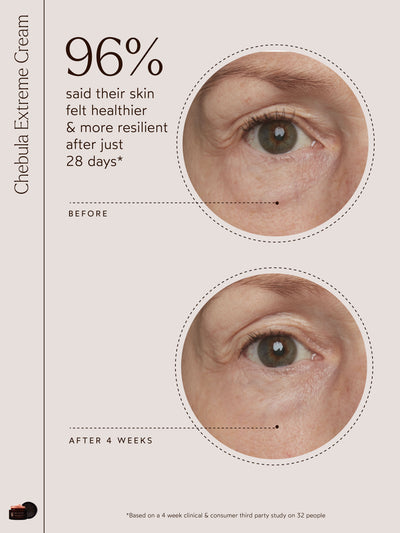 An image highlighting "96% said their skin felt healthier & more resilient after just 28 days*" with before-and-after shots focusing on skin under the eye. Includes Chebula Extreme Cream jar for product reference, supported by a 4-week clinical and consumer study of 32 participants.