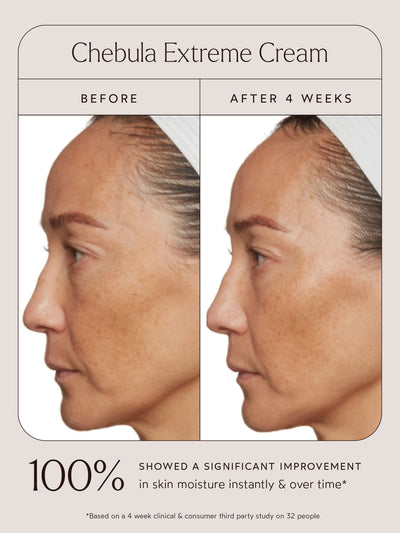 Before and after comparison of a woman's skin using Chebula Extreme Cream. The "Before" image shows visible dryness, dullness, and uneven skin tone, while the "After 4 Weeks" image reveals significantly improved hydration, smoother texture, and a more radiant complexion. Below the images, text highlights that 100% of participants showed a significant improvement in skin moisture instantly and over time, based on a 4-week clinical and consumer third-party study on 32 people.