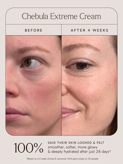 Before and after comparison of a woman's skin using Chebula Extreme Cream. The "Before" image shows visible dryness, uneven texture, and dullness, while the "After 4 Weeks" image reveals smoother, softer, glowing, and deeply hydrated skin. Below the images, text highlights that 100% of participants said their skin looked and felt smoother, softer, more glowy, and deeply hydrated after just 28 days, based on a 4-week clinical and consumer third-party study on 32 people.