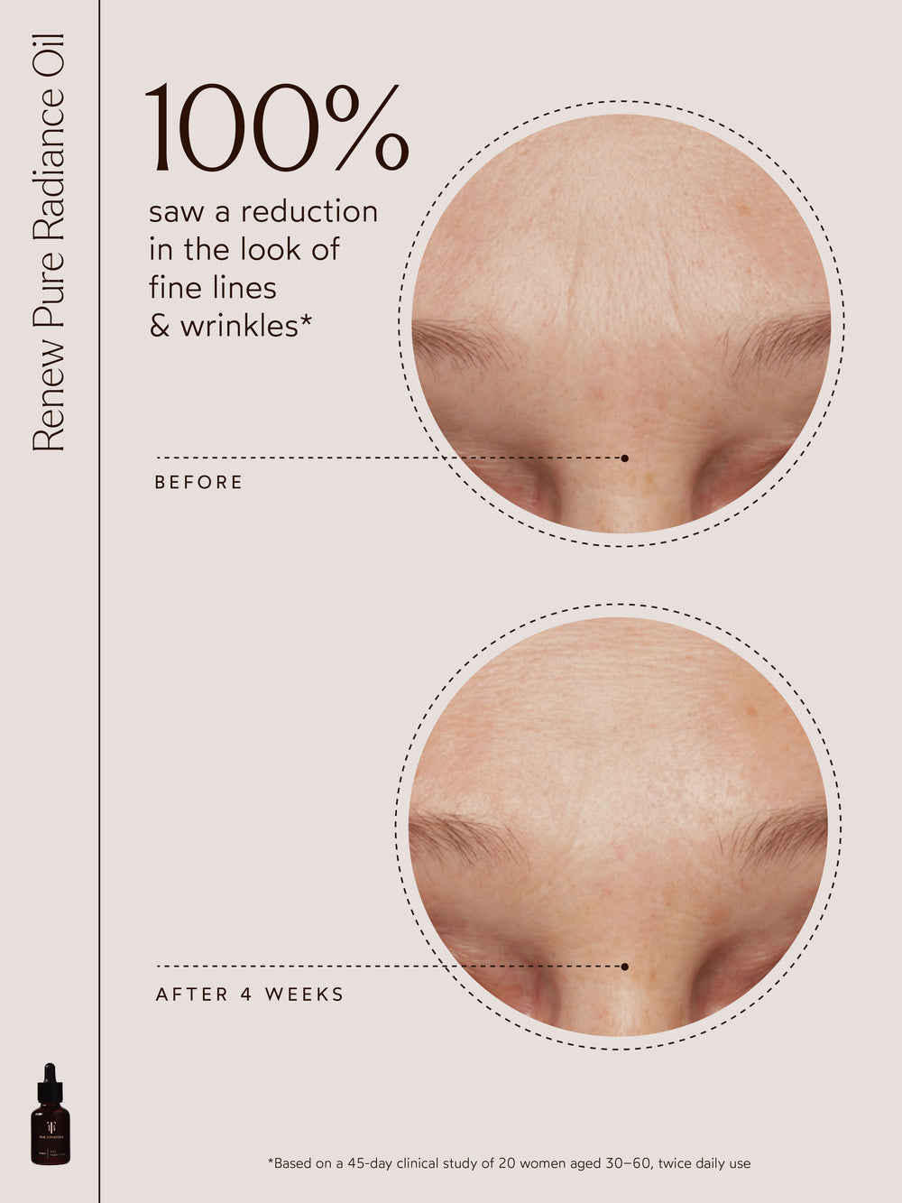 An image showcasing the results of Renew Pure Radiance Oil, with the text "100% saw a reduction in the look of fine lines & wrinkles*." Two close-up images show a "Before" forehead with visible fine lines and an "After 4 Weeks" forehead with smoother skin. A small bottle of Renew Pure Radiance Oil is displayed in the corner. The fine print notes results from a 45-day clinical study with 20 women aged 30–60 using the product twice daily. 