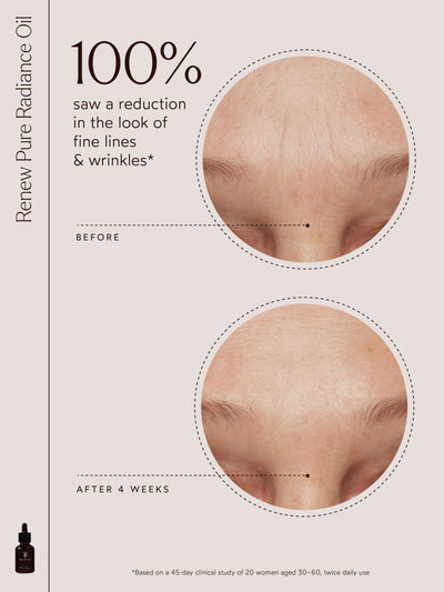 The image showcases "100% saw a reduction in the look of fine lines & wrinkles*" with clear before-and-after results on the forehead area. It includes a small image of the Renew Pure Radiance Oil bottle and references a 45-day clinical study involving 20 women aged 30–60 who used the product twice daily.