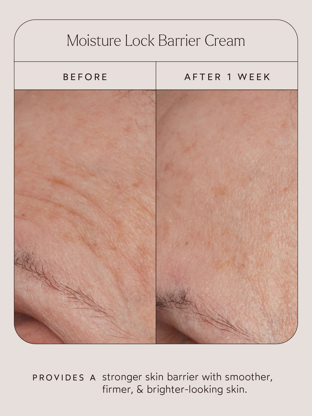 Skin Moisture Lock Skin Moisture Lock