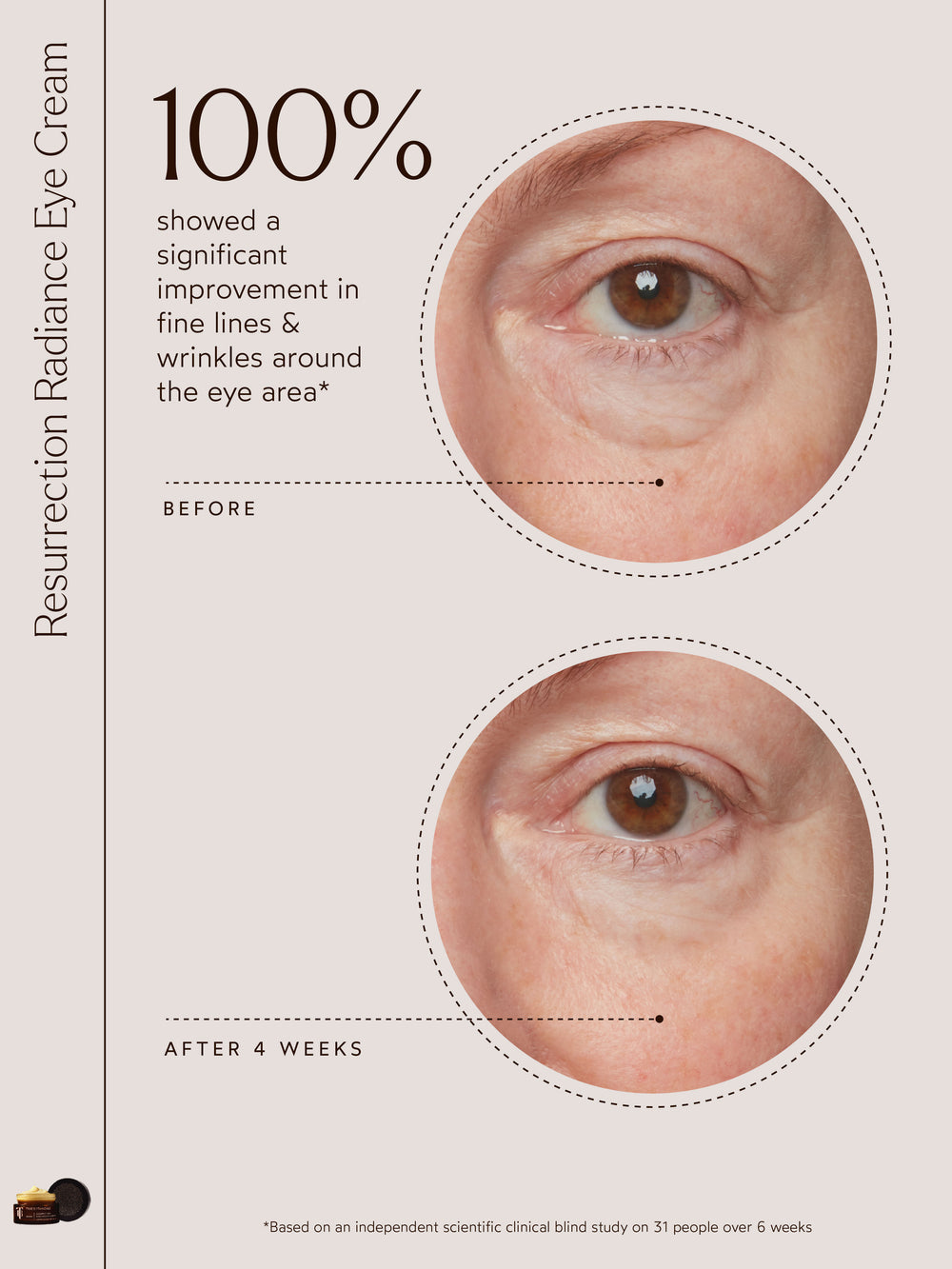 An independent clinical blind study revealed that 100% of participants experienced significant improvement in the appearance of fine lines and wrinkles around the eye area after using Resurrection Radiance Eye Cream. Conducted over six weeks with 31 participants, the study highlights the cream’s effectiveness in rejuvenating and smoothing the delicate skin around the eyes.