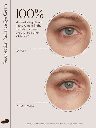 An independent clinical blind study demonstrated that 100% of participants experienced a significant improvement in hydration around the eye area just 24 hours after using Resurrection Radiance Eye Cream. Conducted with 31 participants over six weeks, the study highlights the cream's ability to deliver instant and lasting moisture to the delicate under-eye skin.