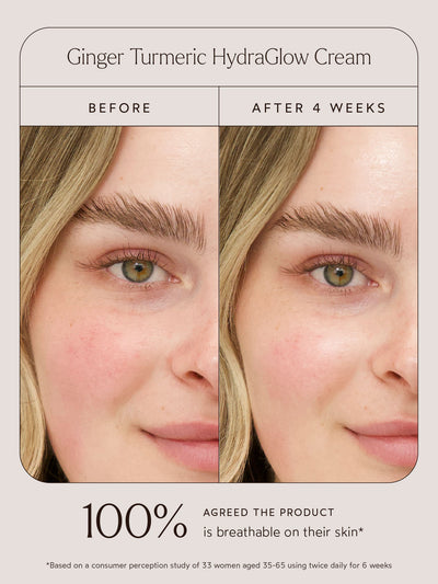 Before and after comparison of a woman using Ginger Turmeric HydraGlow Cream. The left image shows her skin before use, with visible redness and dryness, while the right image, labeled "After 4 Weeks," shows smoother, more hydrated, and radiant skin. Below the images, text highlights that 100% of users agreed the product is breathable on their skin, based on a consumer perception study of 33 women aged 35–65 using the product twice daily for 6 weeks.