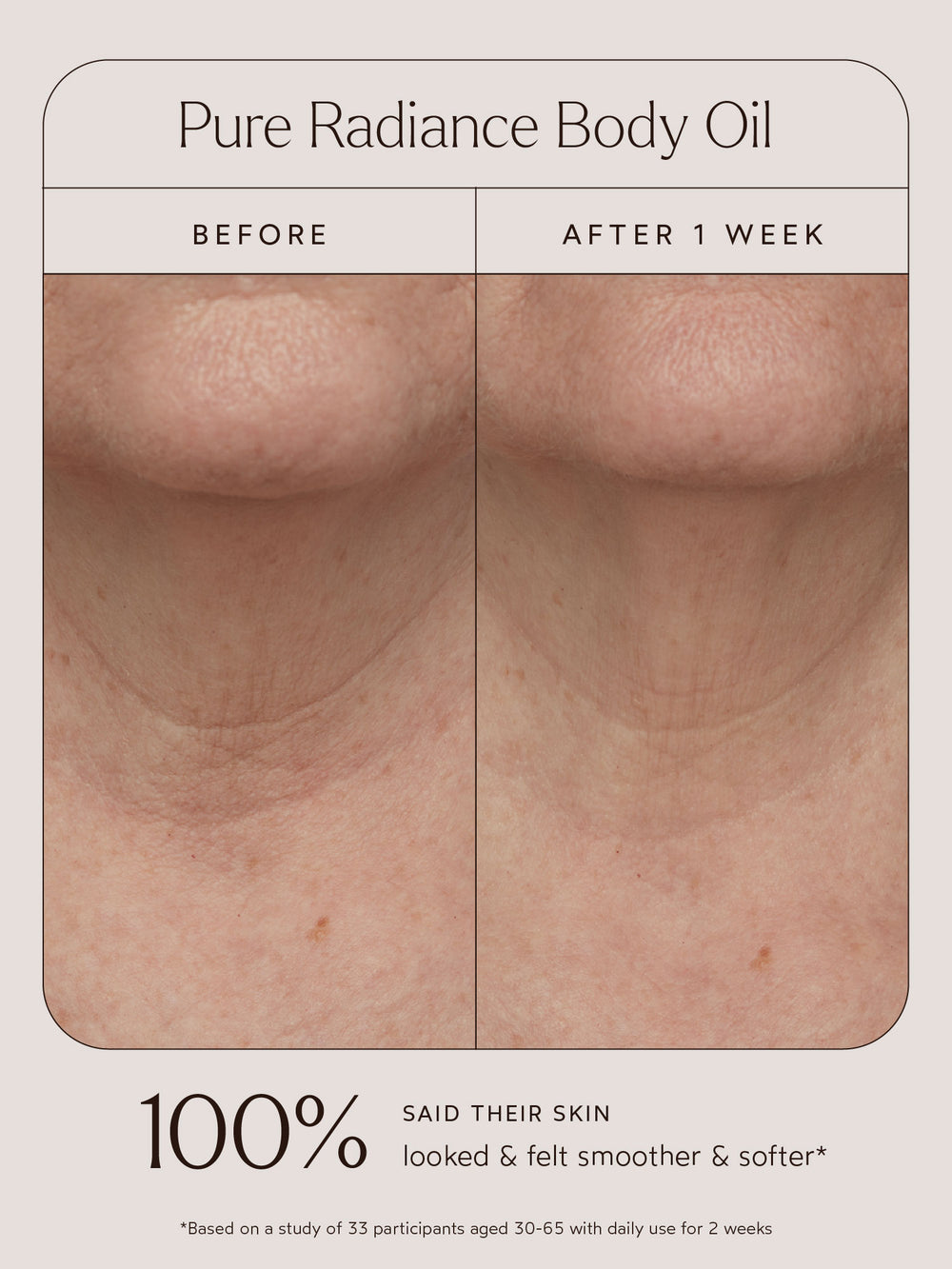 Before and after comparison of a user’s neck area using Pure Radiance Body Oil. The left image shows skin before use, with visible dryness and uneven texture, while the right image, labeled "After 1 Week," shows smoother, softer, and more hydrated skin. Below the images, text highlights that 100% of participants said their skin looked and felt smoother and softer, based on a study of 33 participants aged 30–65 with daily use for 2 weeks.