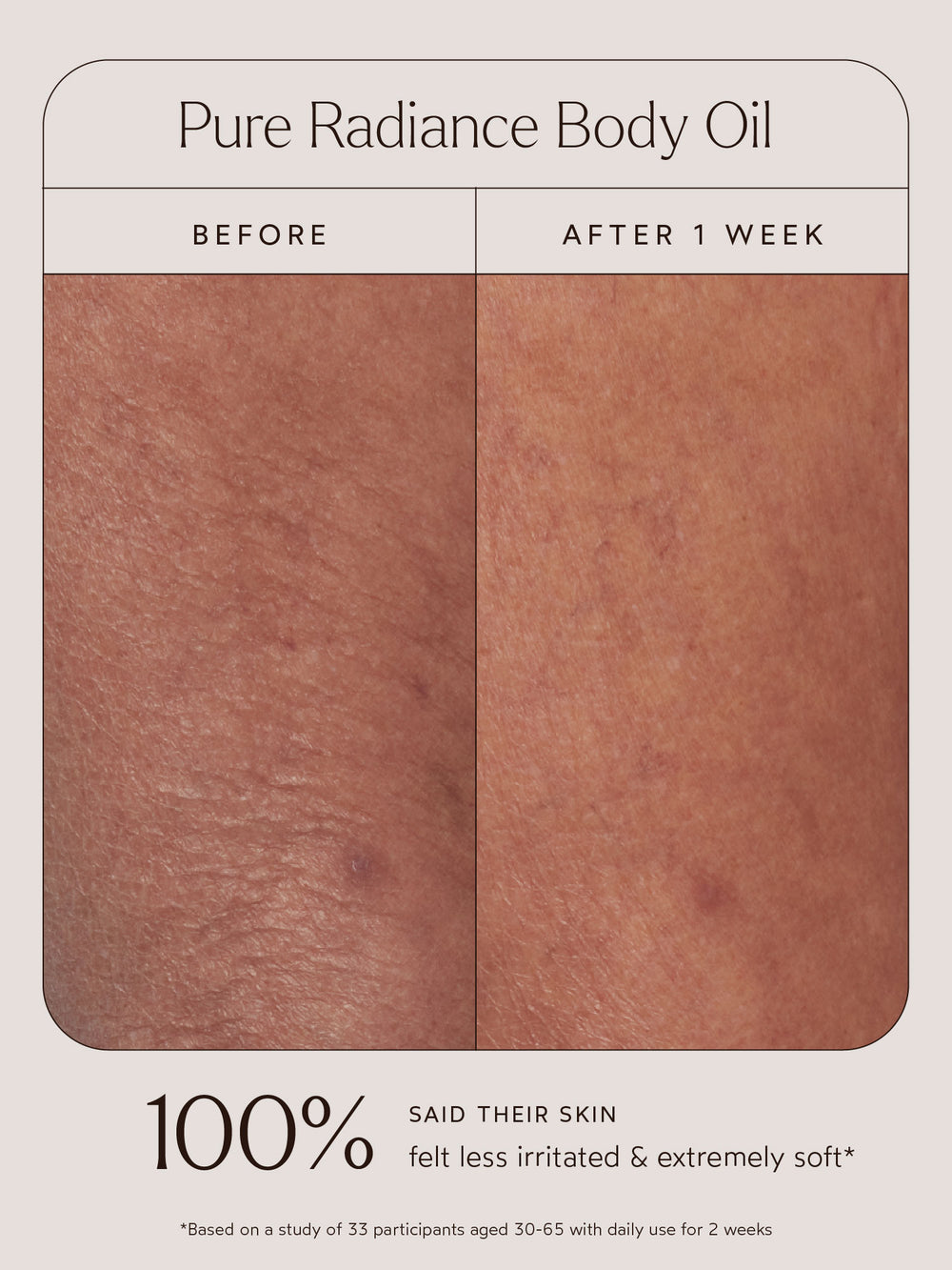 
Before and after comparison of a close-up of skin using Pure Radiance Body Oil. The left image shows skin before use, with visible dryness and irritation, while the right image, labeled "After 1 Week," displays softer, more hydrated, and calm skin. Below the images, text highlights that 100% of participants said their skin felt less irritated and extremely soft, based on a study of 33 participants aged 30–65 with daily use for 2 weeks.