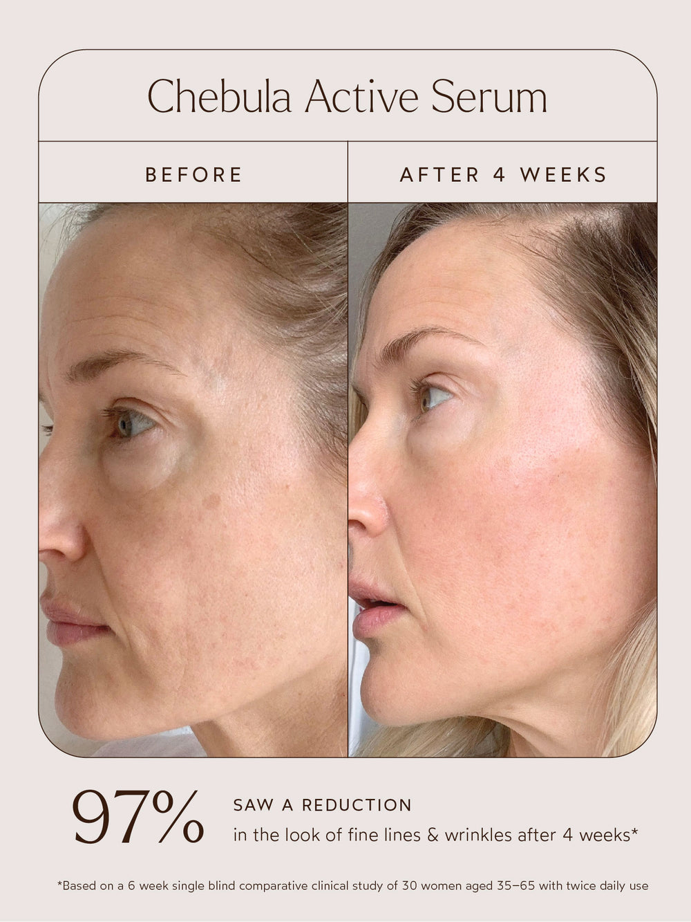 A before-and-after comparison image for Chebula Active Serum showing visible improvements in skin after 4 weeks. The "Before" side highlights fine lines and uneven texture, while the "After" side reveals smoother, more refined skin. Text notes 97% saw a reduction in fine lines and wrinkles, based on a 6-week clinical study of 30 women aged 35–65 using the serum twice daily.