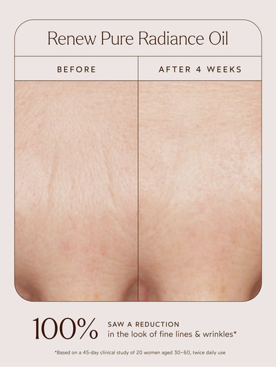 This compelling visual demonstrates the transformative results of Renew Pure Radiance Oil. After just 4 weeks, 100% of participants saw a visible reduction in fine lines and wrinkles. Proof that luxurious hydration delivers real, age-defying benefits.