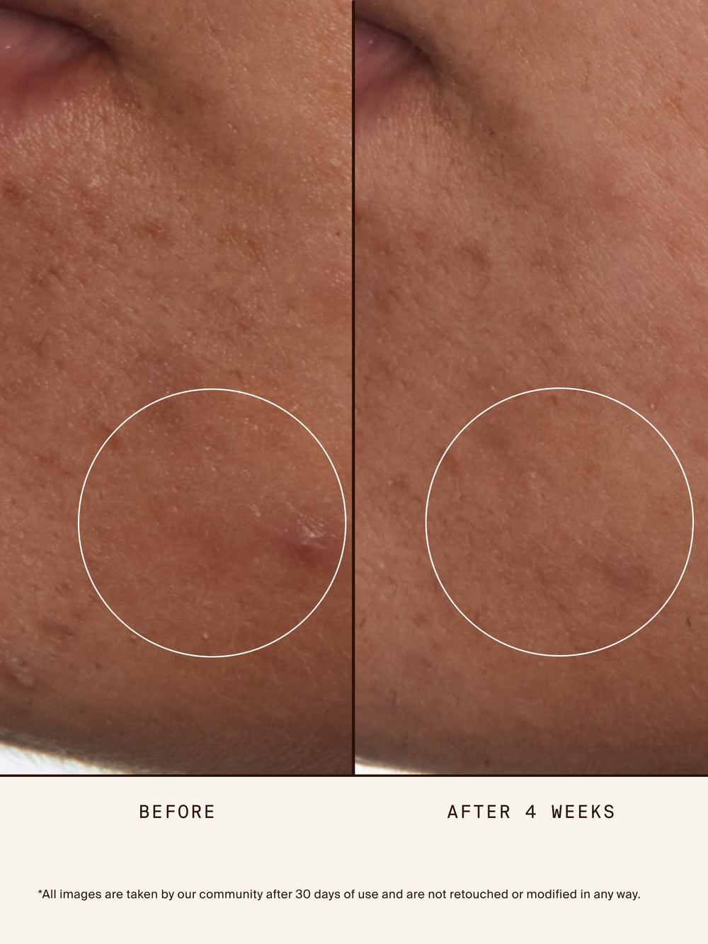 At-Home Facialist Peel