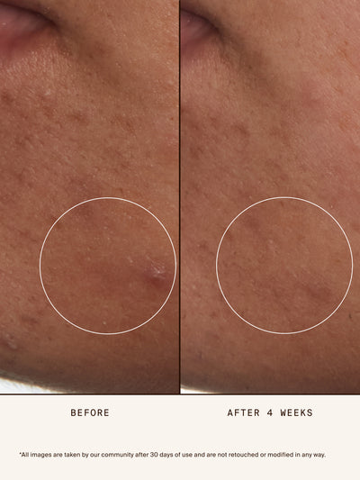 At-Home Facialist Peel