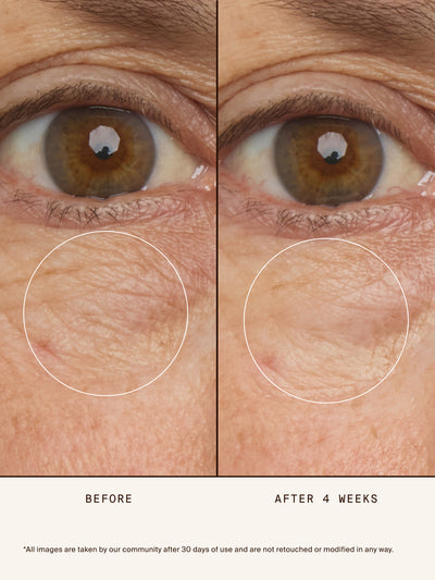 Chebula Multi-Corrective Eye Patches