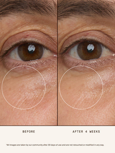 Chebula Multi-Corrective Eye Patches