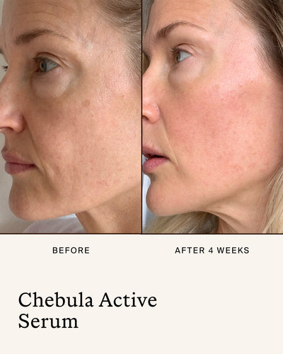 Before-and-after close-up showing the appearance of skin before and after 4 weeks of using True Botanicals Chebula Active Serum.