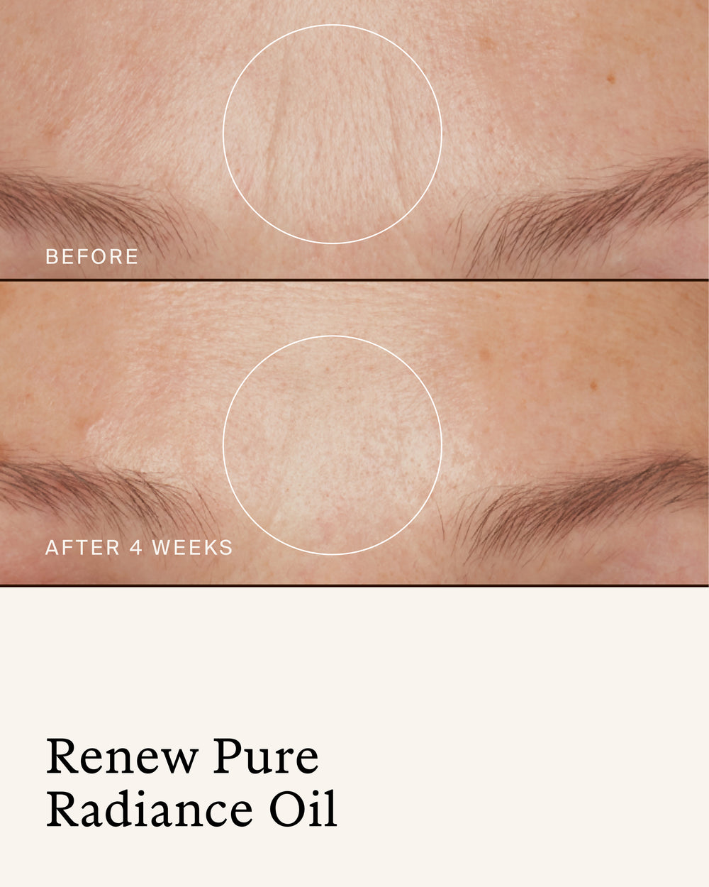 Before-and-after close-up showing the appearance of forehead fine lines before and after 4 weeks of using True Botanicals Renew Pure Radiance Oil.