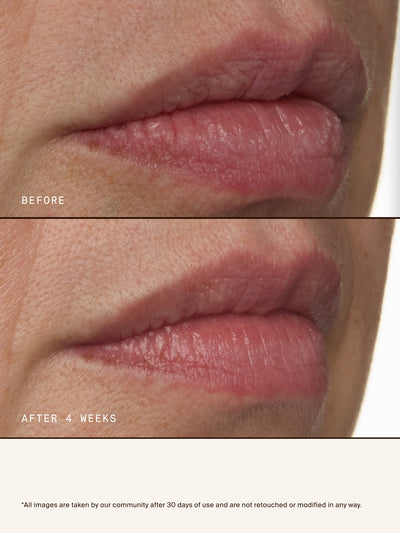 Pure Radiance Overnight Lip Treatment