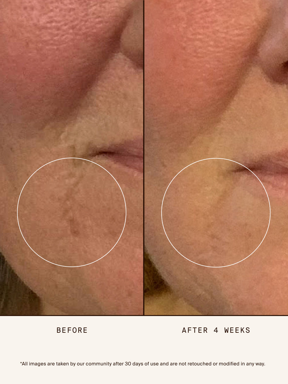 Renew Repair Nightly Treatment