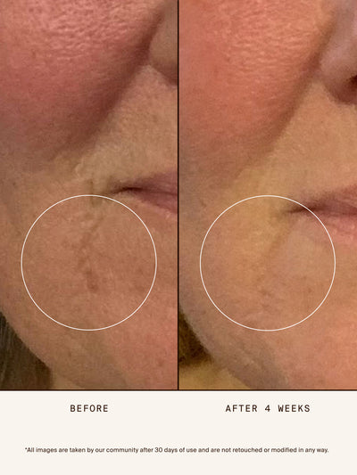 Renew Repair Nightly Treatment