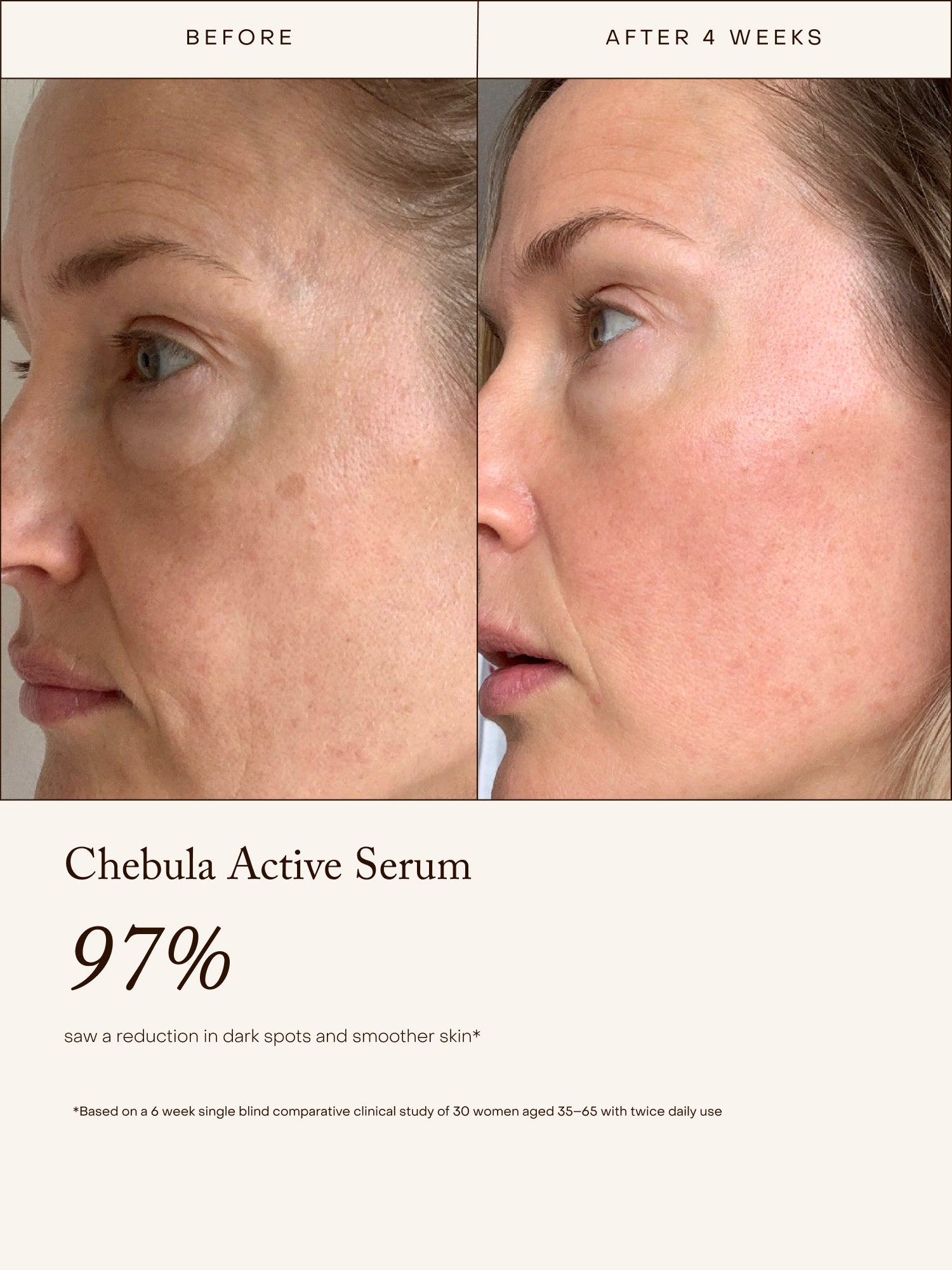 A True Transformation - True Botanicals