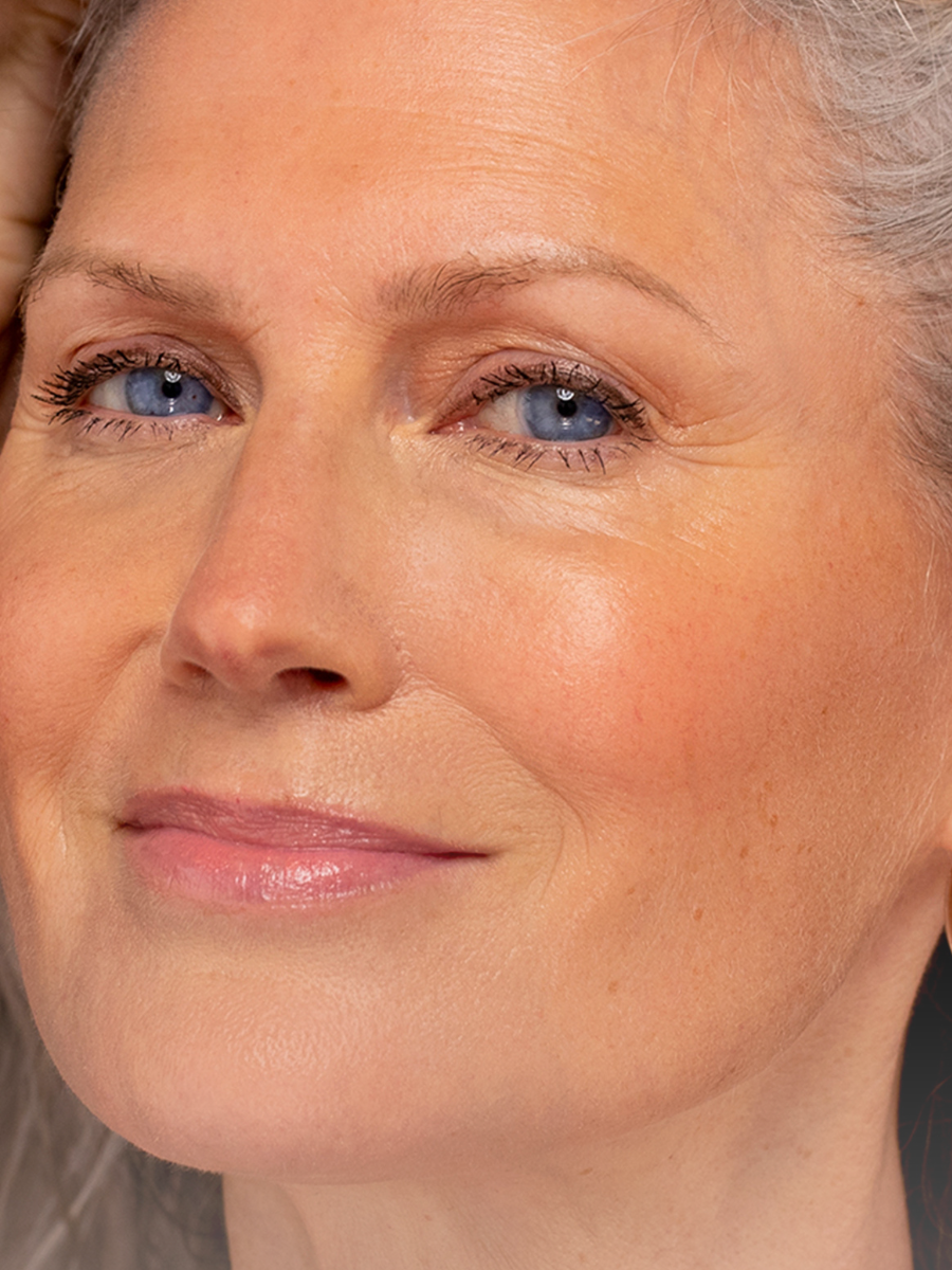 Close-up of a mature woman with blue eyes and glowing skin, showcasing a natural, radiant complexion.