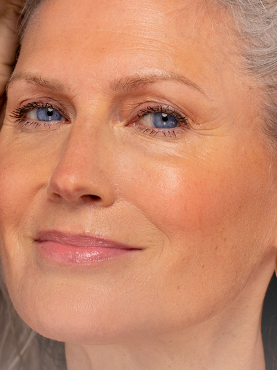 Close-up of a mature woman with blue eyes and glowing skin, showcasing a natural, radiant complexion.