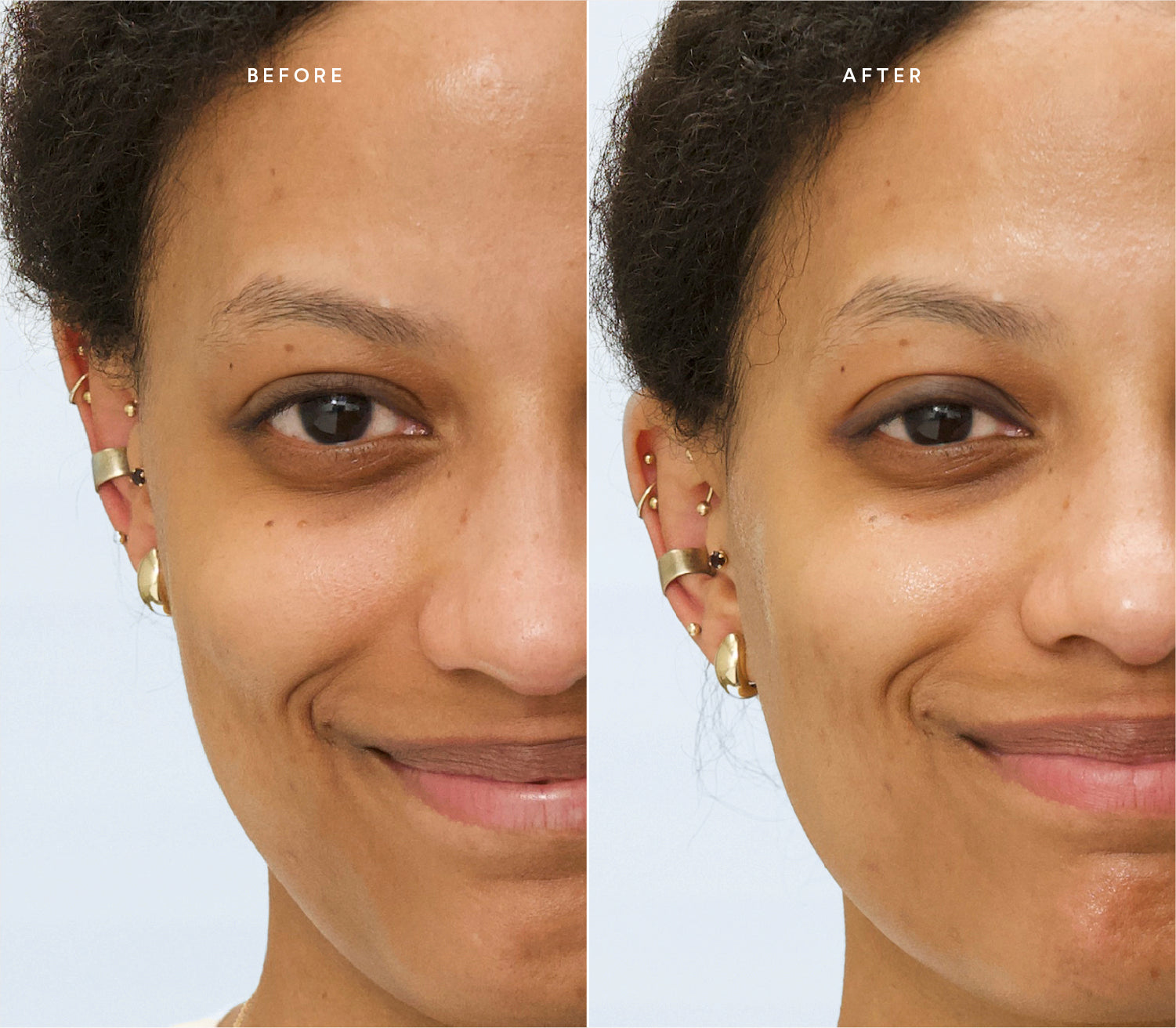 Before and after comparison showing brighter under-eye area and a more radiant, even complexion.