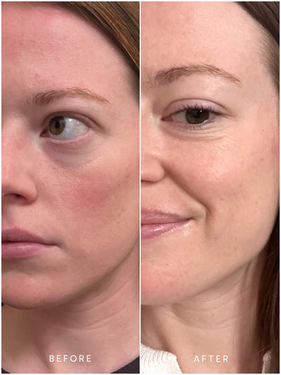 True Botanicals Before/After - Thumbnail Image