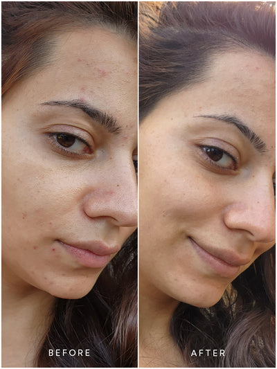 Before/After Renew Pure Radiance Oil | True Botanicals