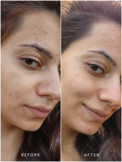 Before/After Renew Pure Radiance Oil | True Botanicals - Thumbnail Image