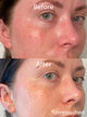 3 Step Glowy Skin Reset | True Botanicals - Thumbnail Image