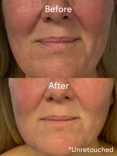 Renew Repair Nightly Treatment Before & After-True Botanicals - Thumbnail Image