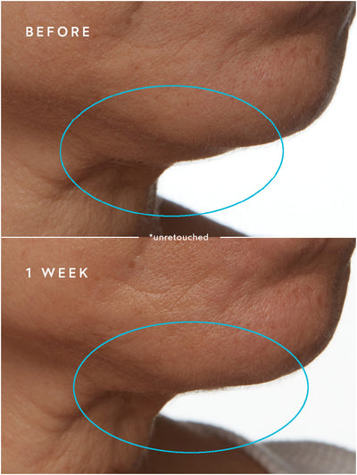 SuperSEA Firming & Lifting Treatment - Thumbnail Image